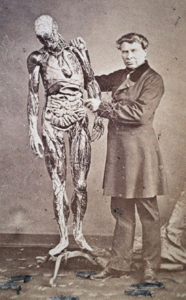 Daguerrotipo de un médico con un modelo anatómico